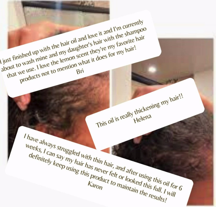 Mia Lynn Naturals Invigorating Oil - Scalp & Hair Booster