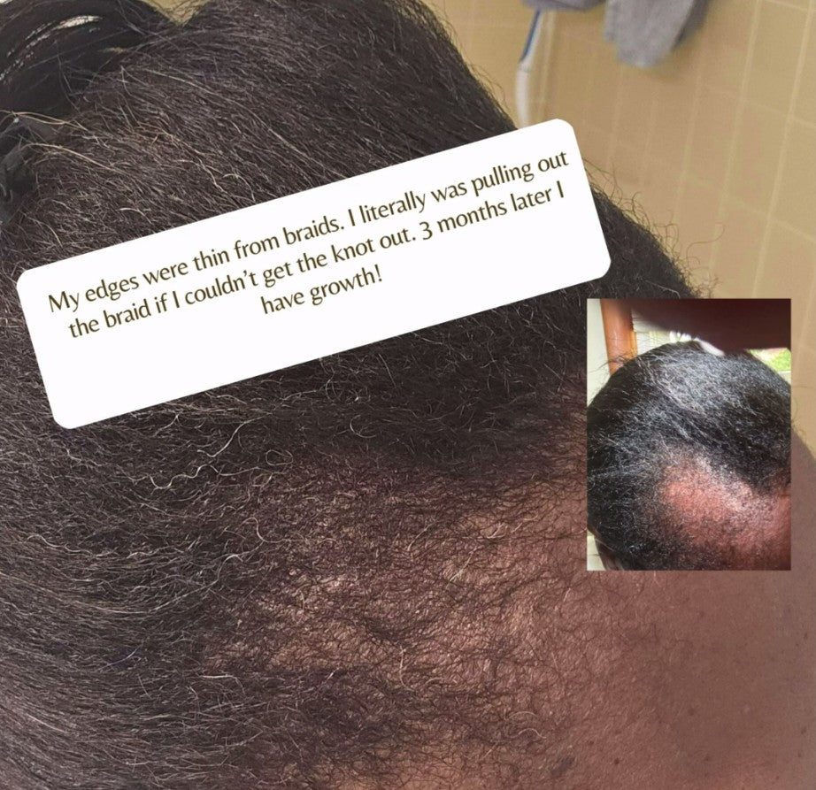 Mia Lynn Naturals Ayurvedic Amla Hair Oil