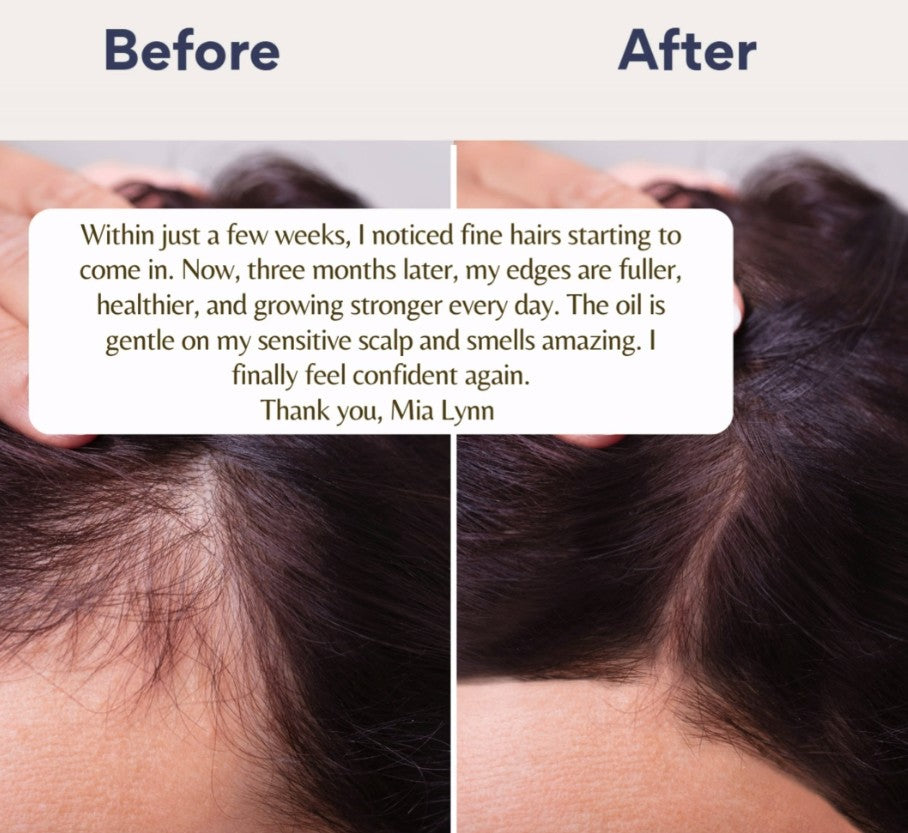 Mia Lynn Naturals Ayurvedic Amla Hair Oil