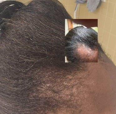Mia Lynn Naturals 4-Step Science Proven Hair Growth Solution
